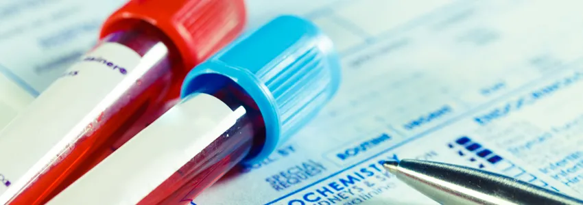Photo of two blood sample tubes.
