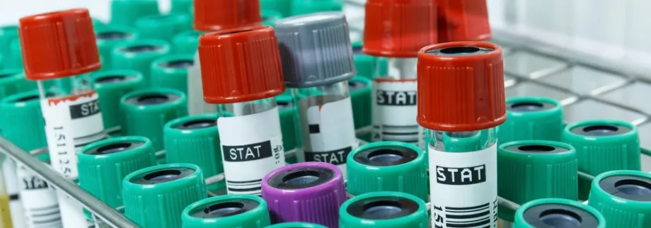 Photo of two blood sample tubes.
