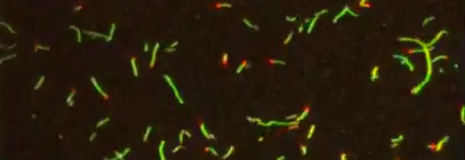 Image of protein filaments on the surface of a microscope coverslip.