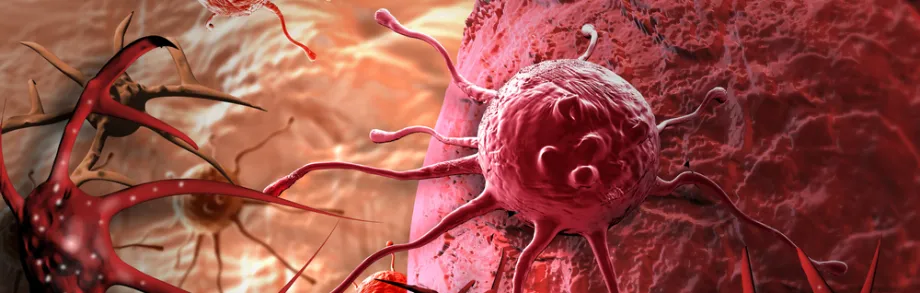 Graphic image of tumor cells.