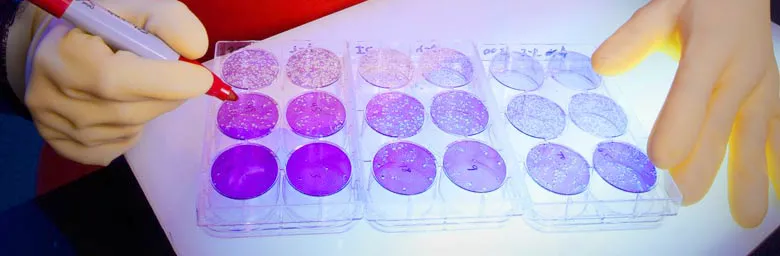 Photo of scientist counting viral plaques at CDC.