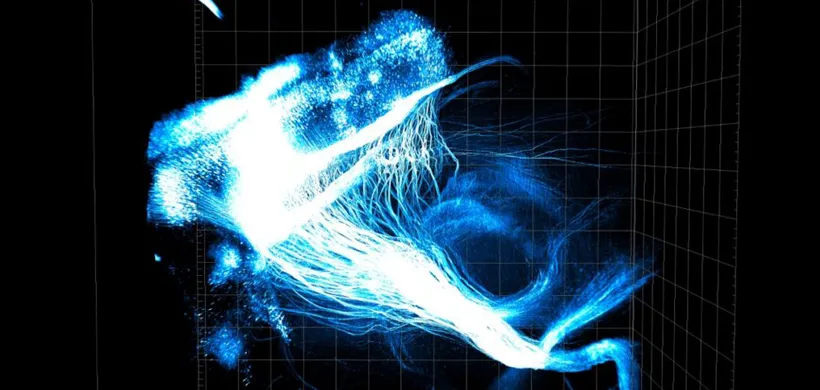 3D CLARITY image shows neural connections from the prefrontal cortex across an entire transparent mouse brain.