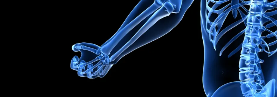 Graphic image of human skeleton.