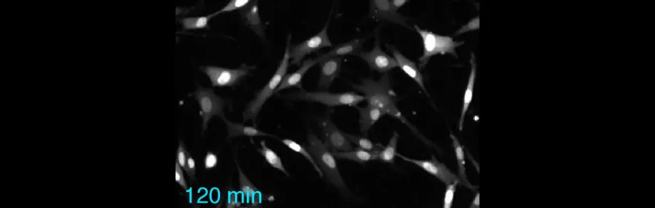 Image from video of cells being stimulated to activate kinases.