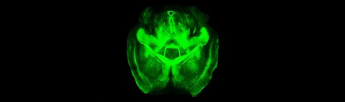 Graphic of a clarified brain image