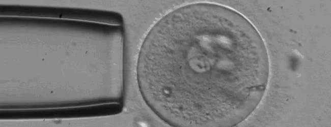 Photo of embryo and pipette.