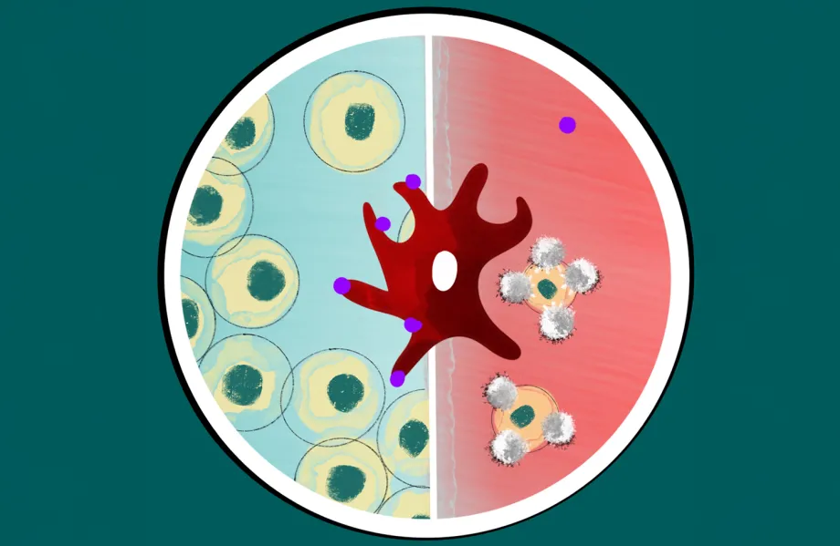 Graphic image of a circle with two sides, the left side blue with cells in it, the right side red with cells being attacked by T cells. A large amorphous red cell sits on the center line of hte circle with purple dots on the blue half-circle side.