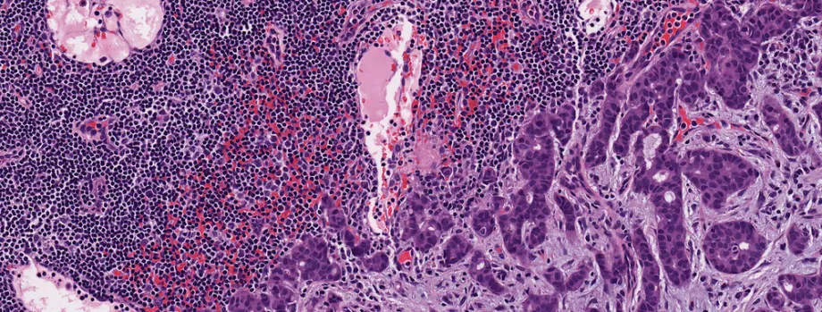 Graphic image of cells preserved in formaldehyde.