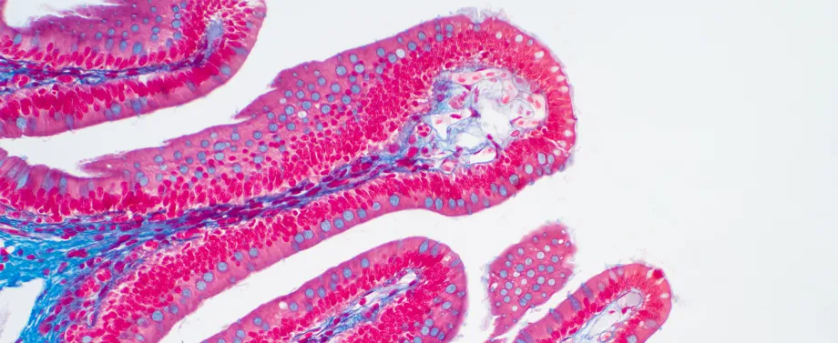 Image of villi cells in bright pink and blue on a white background.