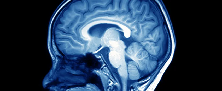 Imge of an MRI of a person's brain depicted in blue and white.