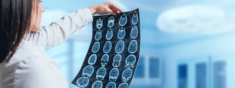 Photo of a female doctor holding up a set of X-rays of a patient's head.
