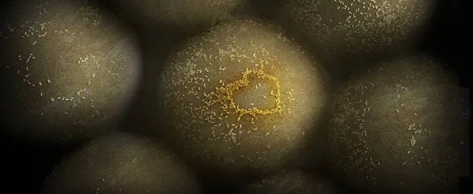 Minuscule gold nanoparticles glom onto and help identify tumor cells.