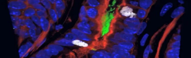 Image of stomach tissue.