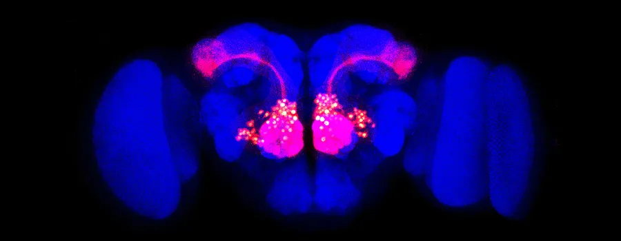 Image of a fly brain showing clusters and pathways of neurons lit up pink.