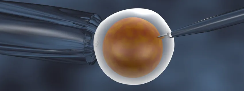 Graphic illustration of a needle being inserted into a fixed cell to represent in-vitro fertilization.
