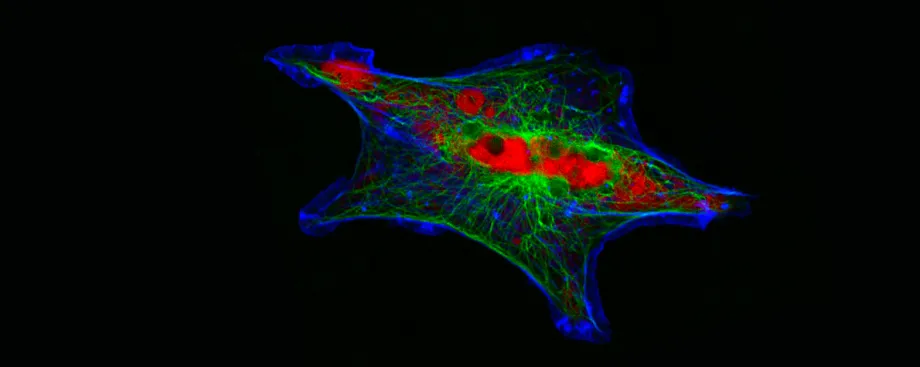 Fluorescent image of a wide, almost star-shaped cell on a black background, with the border of the cell in bright blue, and its interior showing concetrated red bulbs and fibrous green sections around them.