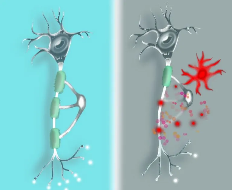 Graphic image of two glia cells, one on a blue background, one on a gray background being attacked by red spots and a red cell.