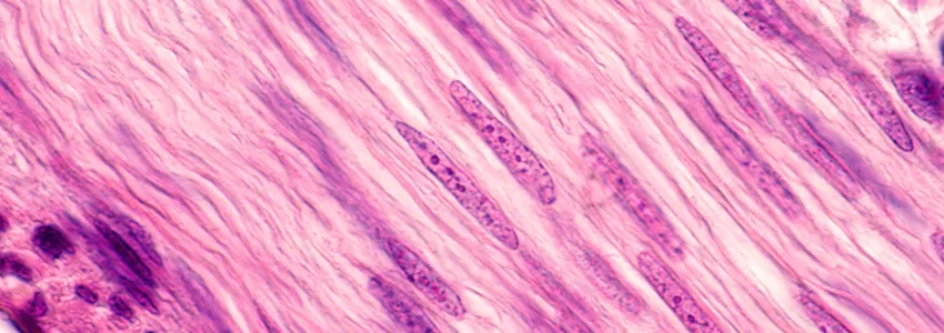 Image of muscle cells showing how long and striated they are.