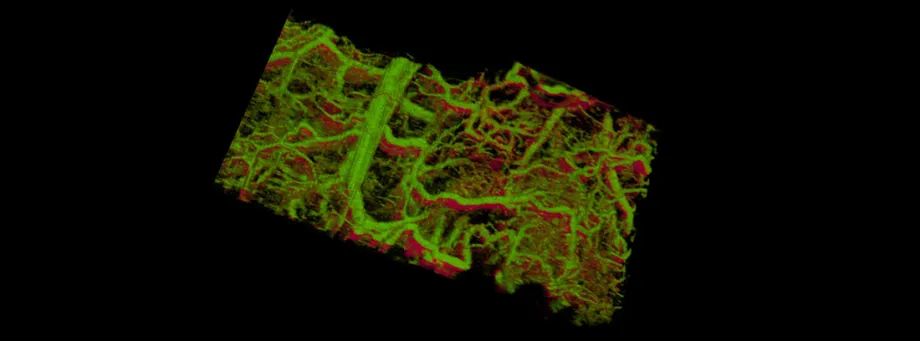 Graphic of blood vessels in mouse ear.