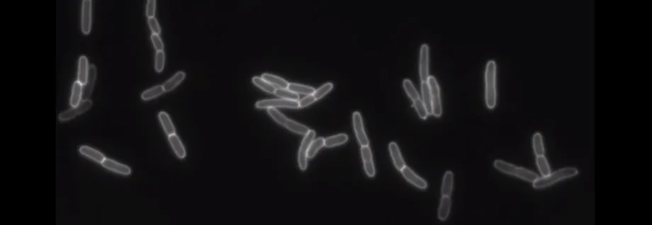 Shocked cells expanding rapidly to a size roughly equivalent to cells growing at full speed in normal solutions
