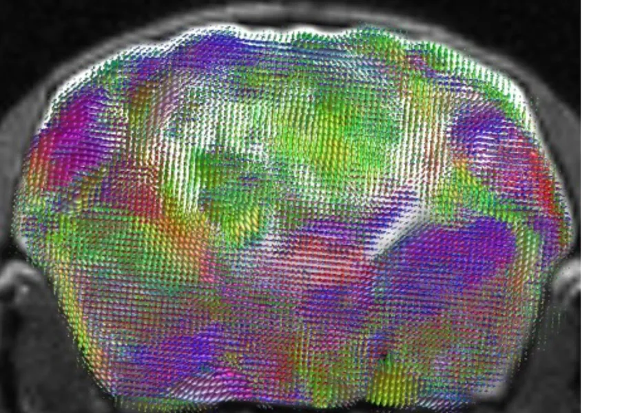  Cross-section MRI scan through a xenocortical mouse brain showing a map of estimated nerve-fiber pathways and directions. 