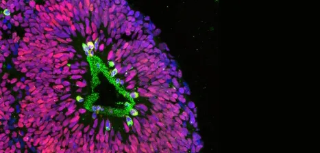 A cross section of a human cortical spheroid.