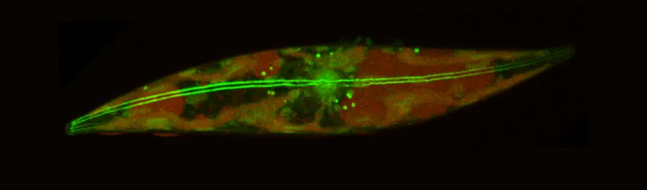 Image of a slender cell on a black background.
