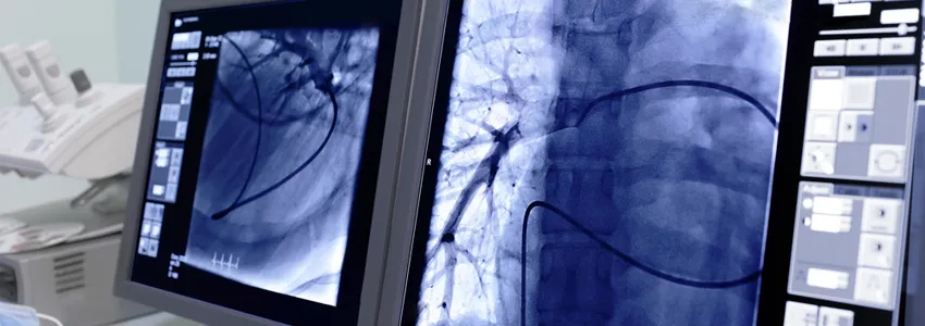 Photo of radiological images on computer screen.