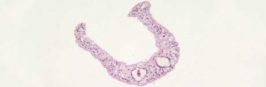 Image of Schistosoma mansonii parasite.