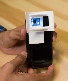 Photo of the OScan smartphone device.