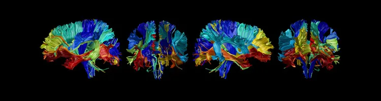 Graphic indicating changes in brain composition with age.