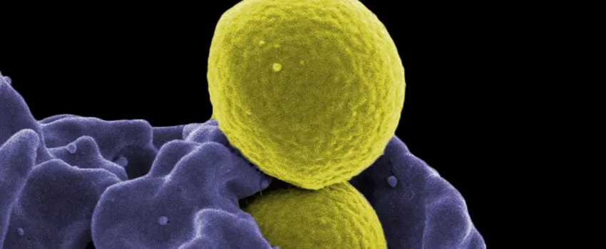Image of a macrophage ingesting bacteria.