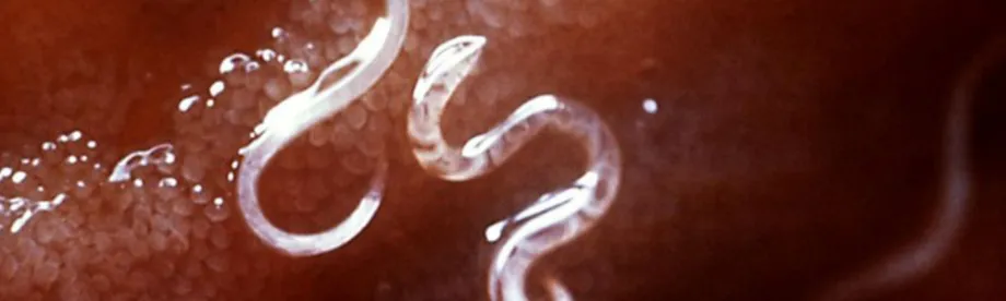 Photo of parasite worms.