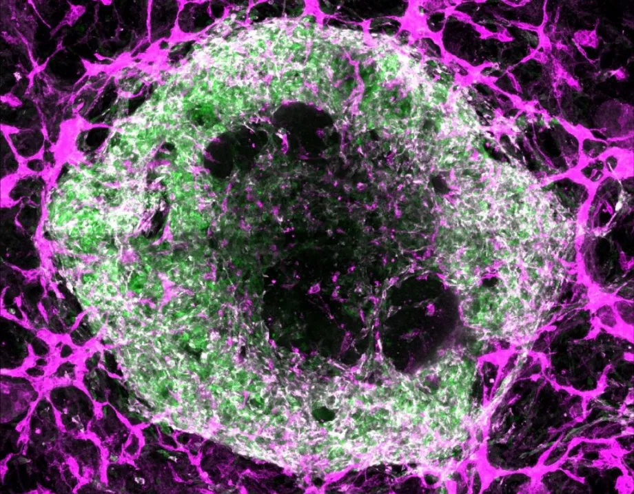 Image of a green and white cell surrounded by a web of purple lines.